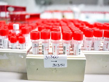 Bebê de 9 meses está entre os 407 novos casos de covid no Piauí; Teresina volta a registrar óbito