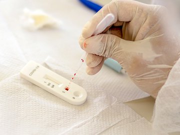 Piauí registra menor número de mortes por covid-19 das últimas 24h em novembro
