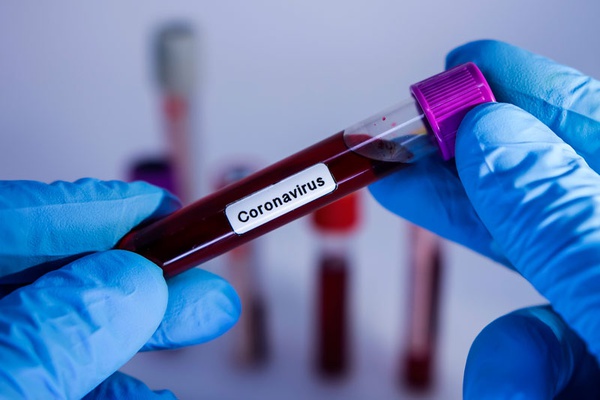 Brasil tem 46 mortos e 2.201 casos confirmados de infecção pelo novo coronavírus