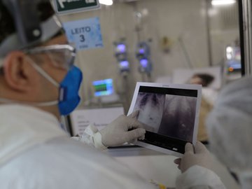 Covid-19: Saúde já investiu R$ 1 bi na habilitação de leitos de UTI