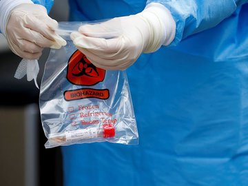 Pesquisadores europeus buscam mais pistas sobre infecção