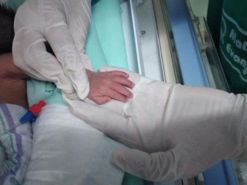 Piauí é o 8º no ranking do Nordeste de nascimento de bebês prematuros