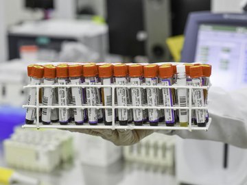 Piauí notifica mais 103 casos de covid e três óbitos em 24h
