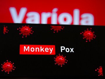 Piauí confirma terceiro caso de varíola dos macacos