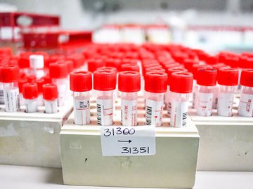 Sobe para 23 o número de casos notificados de varíola dos macacos em Teresina