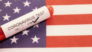Autoridades confirmam 1º caso de coronavírus na capital dos EUA