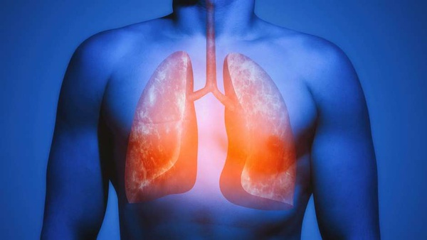 Covid-19 pode deixar problemas crônicos nos pulmões e outros órgãos, como a fibrose pulmonar