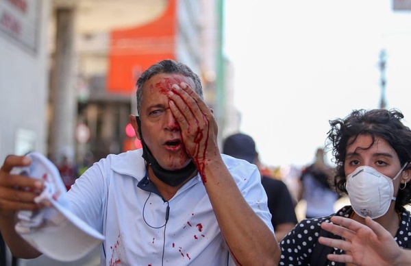 Campelo foi socorrido no Hospital da Restauração, na área central da capital pernambucana.