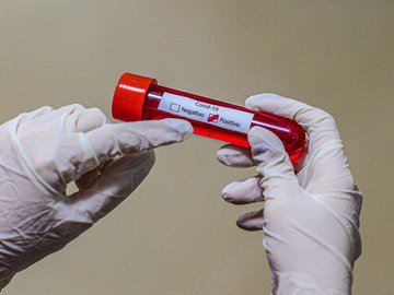 Sesapi registra 4 mortes por covid em 24h e 141 novos casos da doença