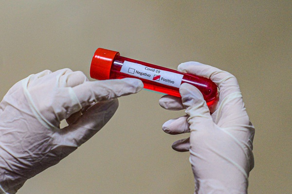 Sesapi registra 4 mortes por covid em 24h e 141 novos casos da doença